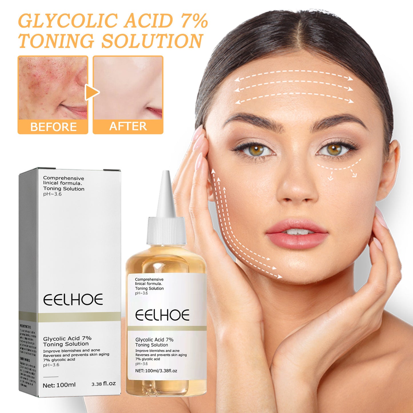 Glycolic Acid 7 Acne Removing Solution
